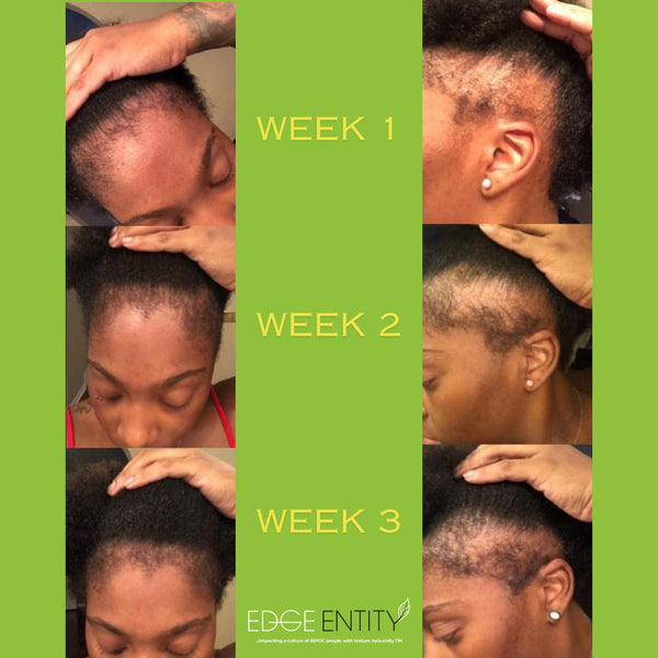 Level up your Edges: The Ultimate Guide to Growth Your Edges in 3 Weeks