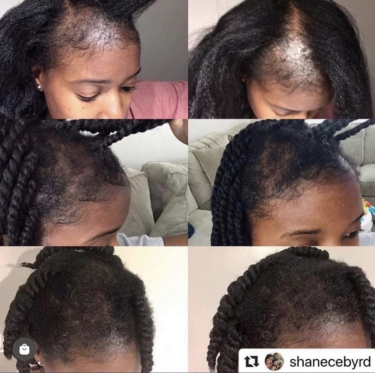 Edge Entity Hair Follicle Stimulant