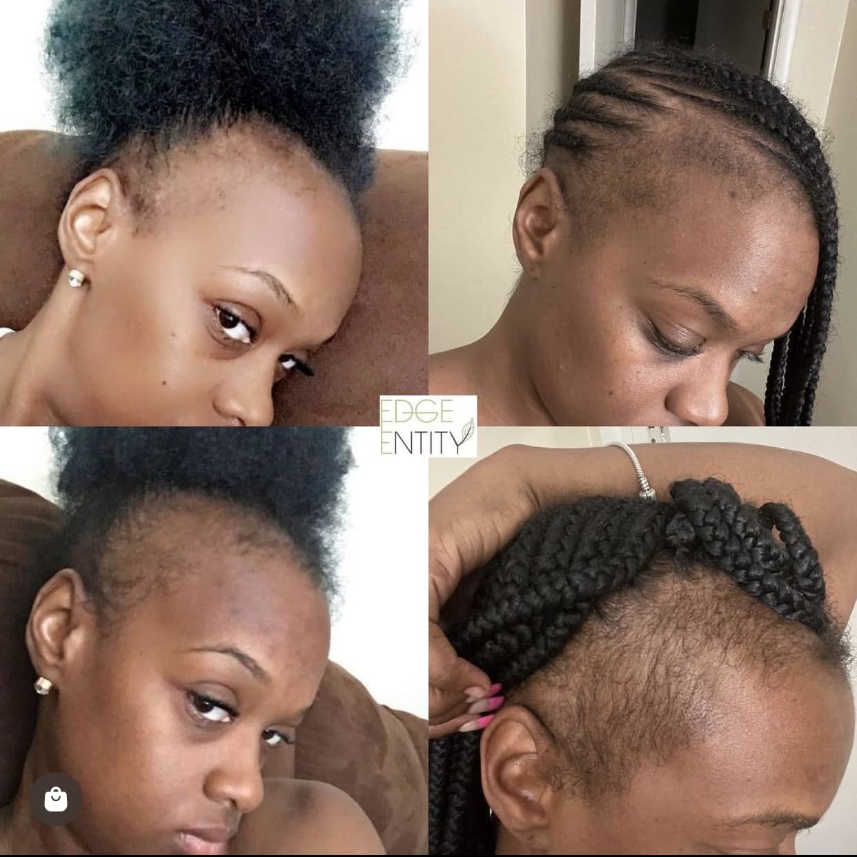 Edge Entity Espresso Hair Growth Oil- 4 oz