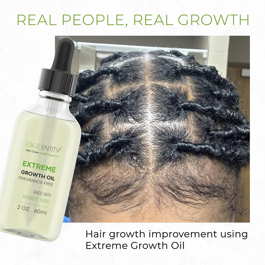 Edge Entity Extreme Growth Oil Fragrance Free