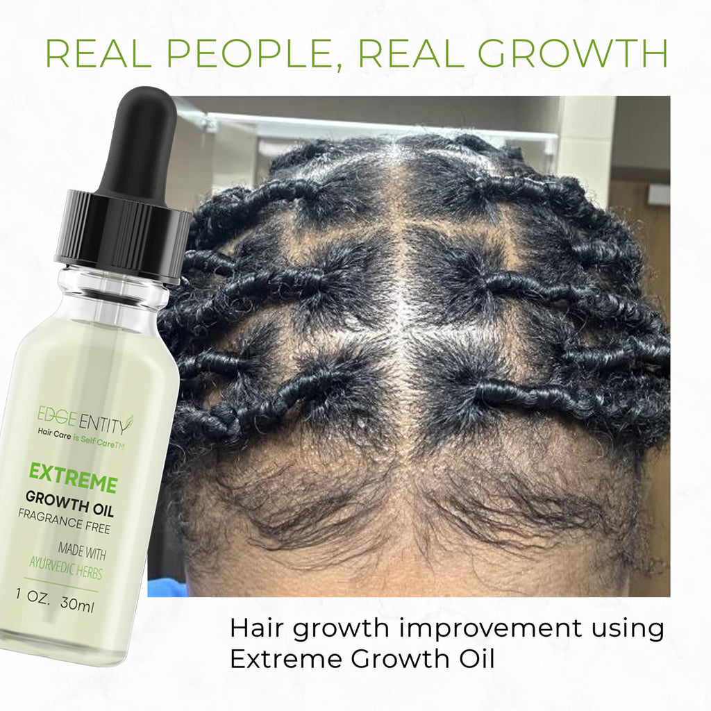 Edge Entity Extreme Growth Oil Fragrance Free