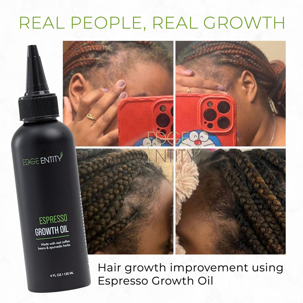 Edge Entity Espresso Hair Growth Oil- 4 oz